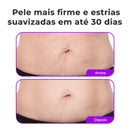 Firmelle – Creme Firmador Abdominal Que Devolve a Firmeza e Suaviza as Estrias (Oferta Exclusiva)