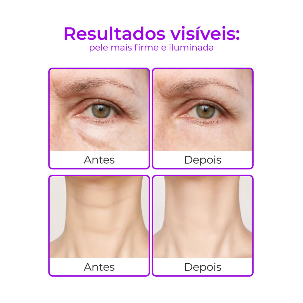 RejuMax - Combo Rejuvenescedor Para Pescoço e Olhos Que Firma e Suaviz