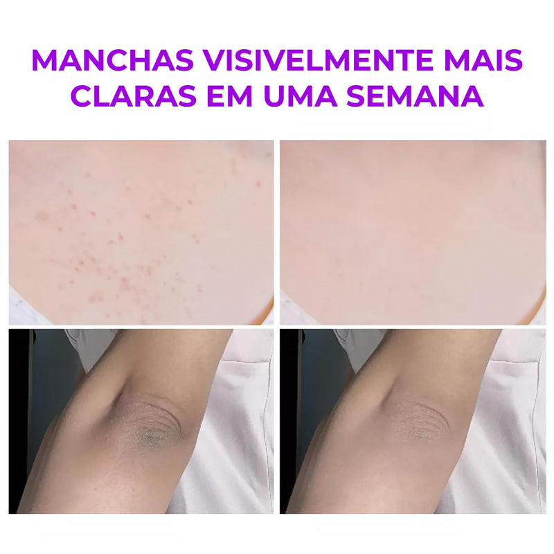 Melashot – Spray Esfoliante Corporal Que Clareia Manchas e Deixa a Pele Lisa e Iluminada em Minutos (Oferta Exclusiva)