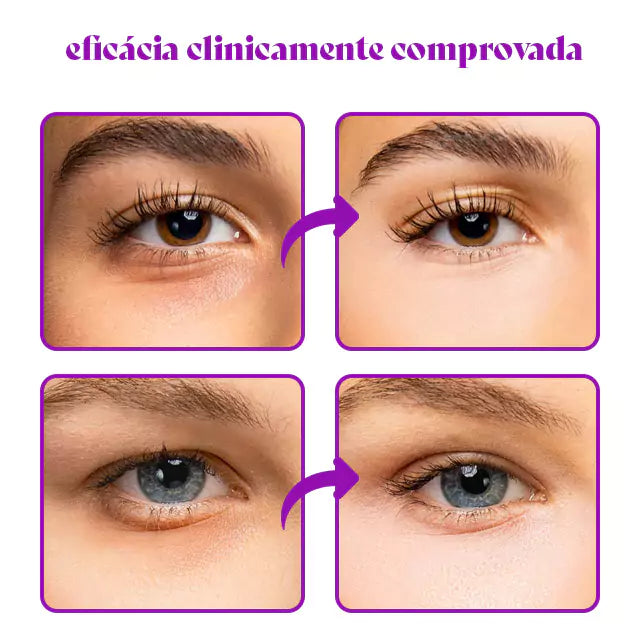 Illuminous - Corretor de Olheiras Que Ilumina e Neutraliza Tons Escuros