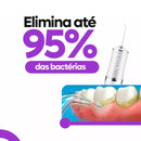 WaterJet - Limpador Bucal Que Limpa e Remove Placas Dos Dentes Através De Água Pressurizada